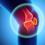 Orthopedics Knee Specialty 
